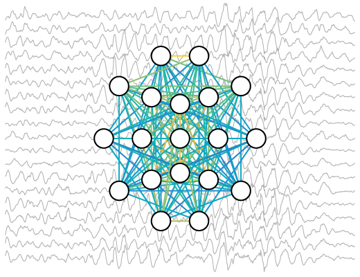 Quantitative EEG biomarkers for neurodevelopmental disorders