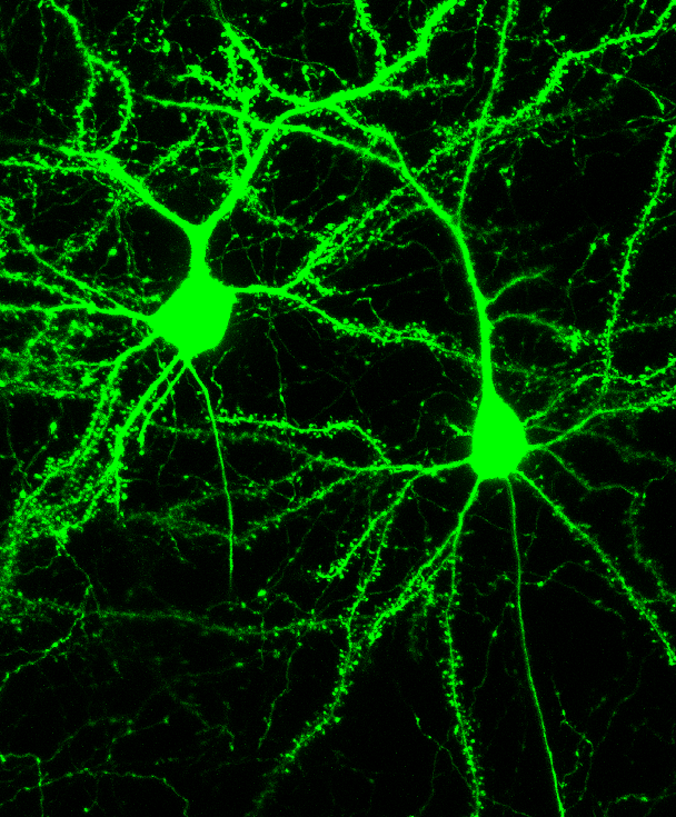 Two neurons filled with a GFP label
